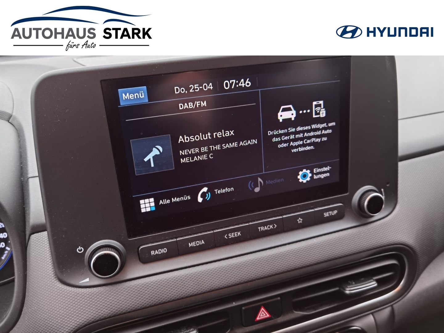 Fahrzeugabbildung Hyundai KONA Select 48V 2WD 1.0 T-GDi Winter-Paket Kamer